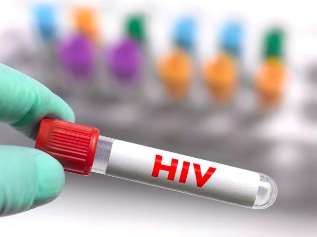 感染了HIV不等于得了艾滋病 科學防艾不再恐艾