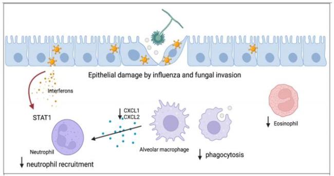 4歲女童甲流合并細菌感染“白肺” 警惕混合感染風險