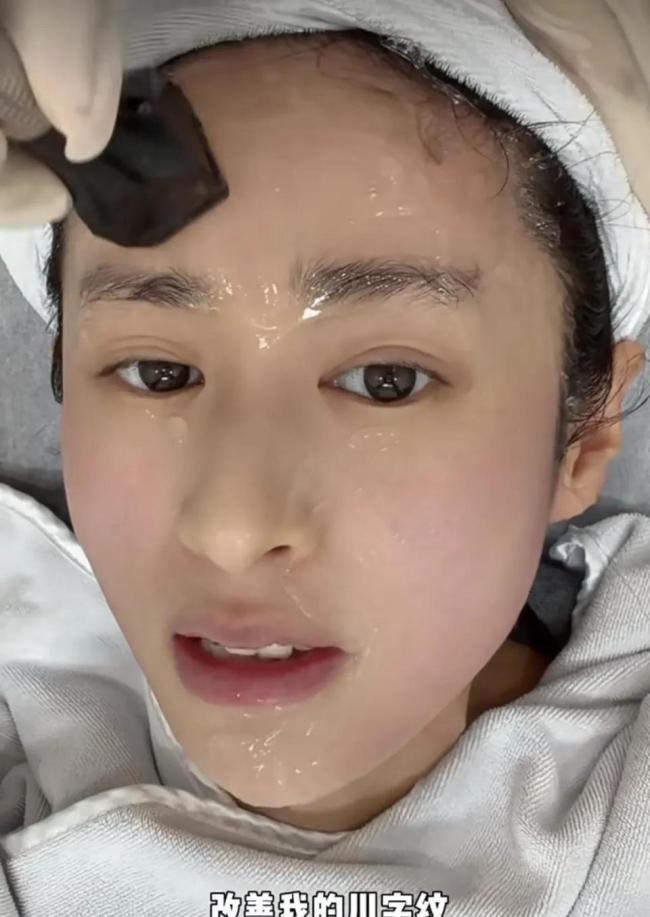 颖儿做眼部热玛吉疼哭了 明星的美丽代价