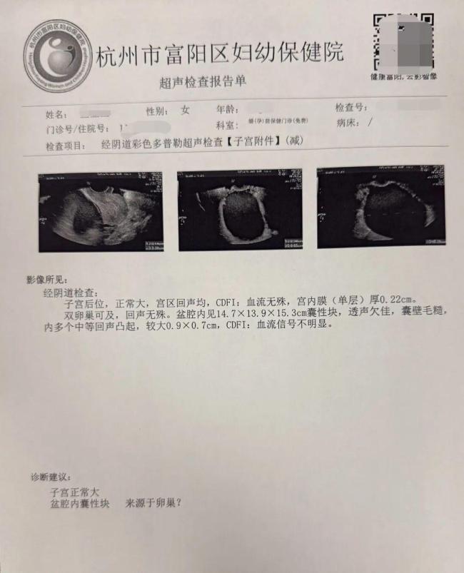 女子婚检意外查出巨大囊肿 及时手术保生育计划