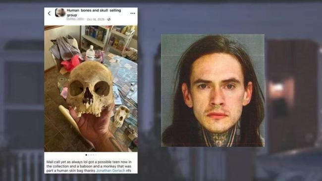 美一男子涉嫌出售人类遗骸被捕 面临500余项指控