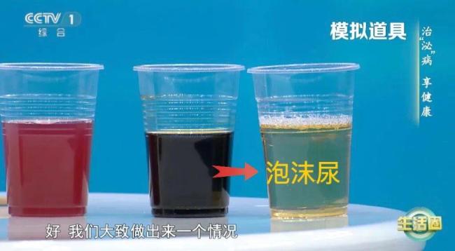 身体出现哪些信号是肾脏在求救