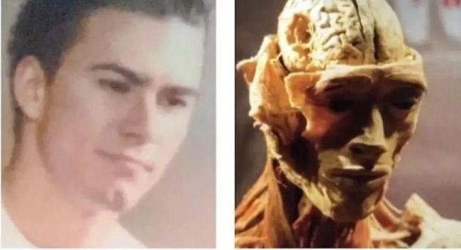 番邦母亲看东谈主体展览发现女儿遗体