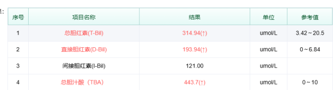 须眉得漠视病腹痛10年全身变黄 忽视小痛酿大祸