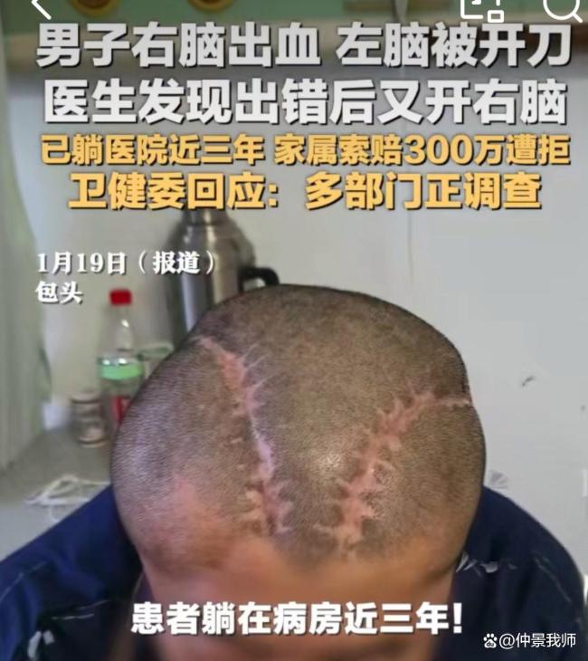 左脑开错刀是手术安全流程的全面失守