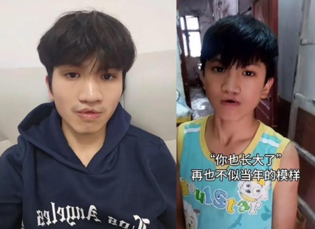 嫣然天使基金受益者发声 感恩回馈社会