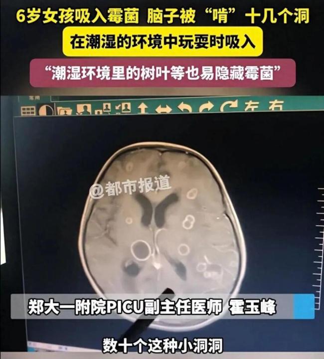这种致癌物藏在家里 许多东谈主浑然不知 霉菌挟制健康