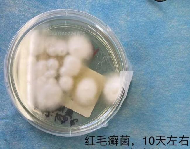 这种致癌物藏在家里 许多东谈主浑然不知 霉菌挟制健康