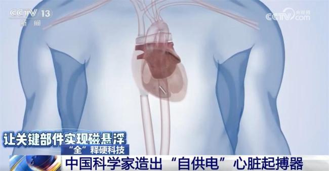 用心跳供电 中国科学家造出“自供电”心脏起搏器 心跳化作能量源泉