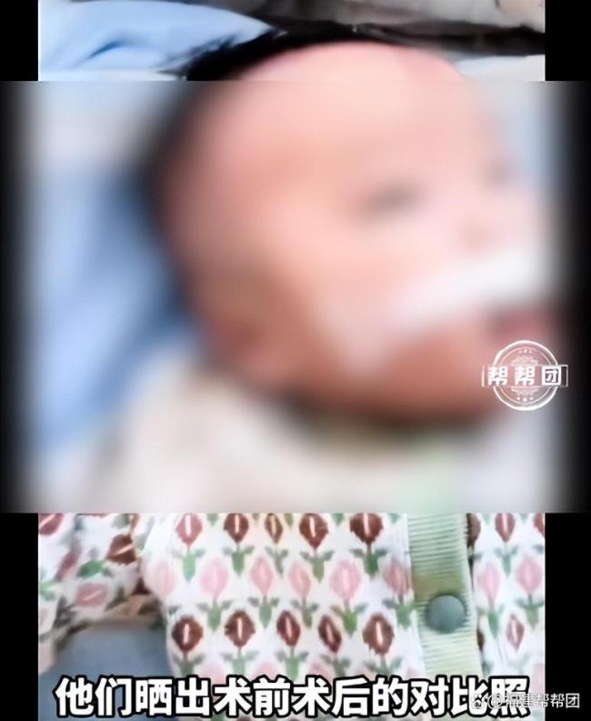 百名受益者勇敢晒照声援嫣然医院 众多唇腭裂受益者力挺李亚鹏