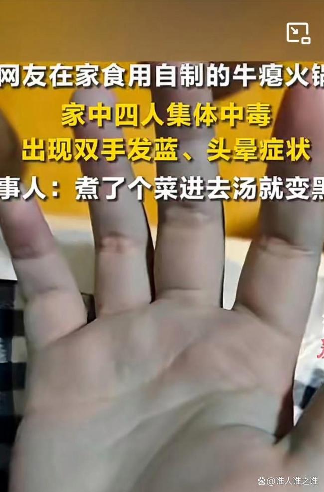 一家人吃自制牛瘪火锅中毒双手变蓝