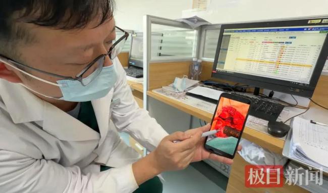 钢筋从天降络续女子总共胸腹腔 8小时存一火救助创造古迹