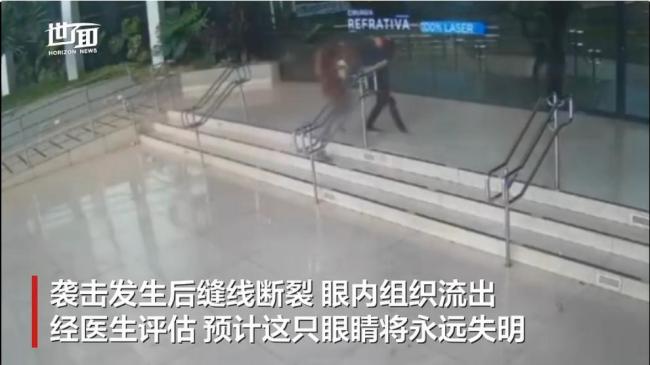 巴西做角膜移植男子被打或永久失明 术后复诊遇袭悲剧
