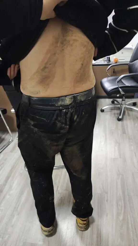 刑警抱住嫌疑人一同滚下陡坡 硬核抓捕展现英勇本色