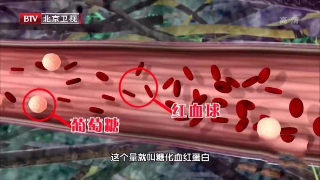 血糖检测5个“隐性指标”别忽视 控糖更安心