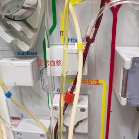 25岁小伙血液变白确诊3种致命病症 不良生活习惯惹祸