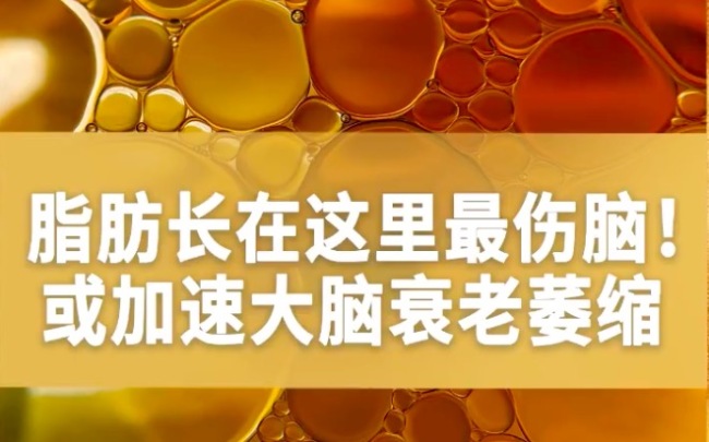 爱穿带帽卫衣的那批人被年龄攻击了，脂肪长在这里最伤脑！或加速大脑衰老萎缩