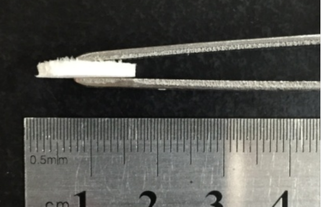 新型“创可贴”让患者免植皮 告别传统植皮痛苦