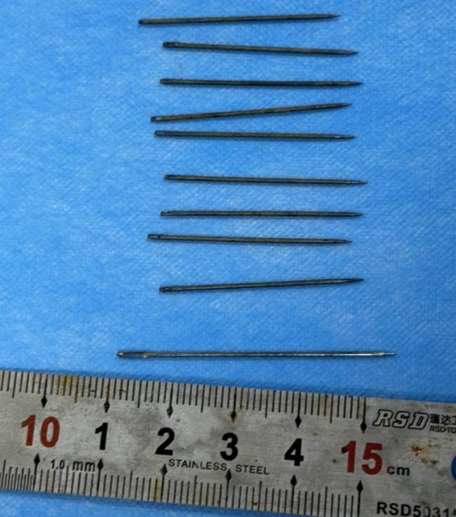 患者误吞12根绣花针每根长4cm 医生紧急救治化险为夷