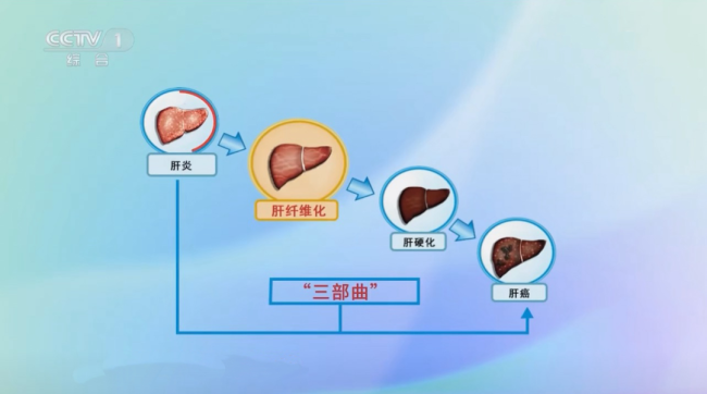 这些信号可能是你的肝在求救