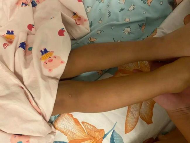 女婴半岁确诊脊柱裂大排畸报告正常 医生无资质引发争议