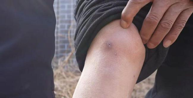 大爷救起落水祖孙 家属登门跪谢恩人 76岁老人勇救两女孩