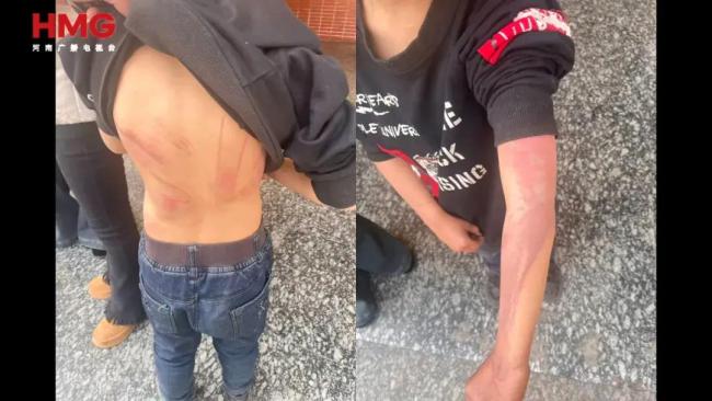 湖南姐弟遭继母生父刻毒细节曝光 狂暴活动令东谈主发指