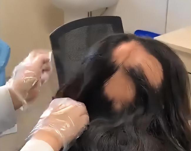 85后宝妈遭遇鬼剃头 辅导作业压力大