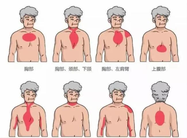 为什么猝死会盯上看似强壮的年轻人