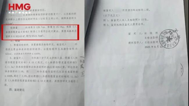 湖南一对姐弟遭生父继母虐待 满身伤痕触目惊心