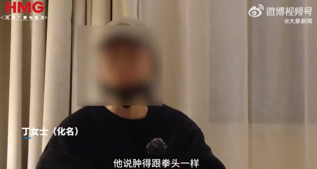 15岁姐姐目睹弟弟被继母虐待全程 生父继母的残忍行径