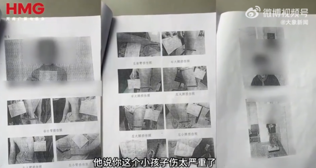 15岁姐姐目睹弟弟被继母虐待全程 生父继母的残忍行径