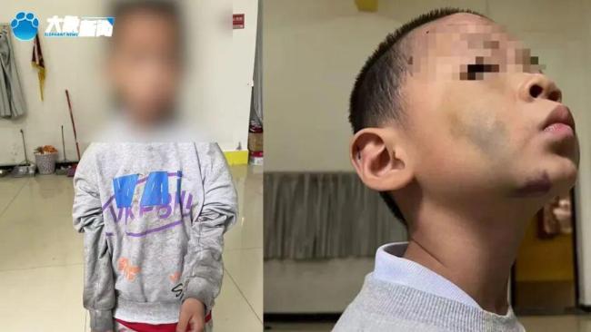 咸宁姐弟遭生父继母虐打 悲惨遭遇曝光