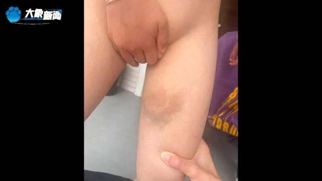 男孩遭继母虐待 求生母不要再婚 残忍虐待震惊社会