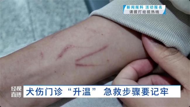 须眉看到狗打架拉架被握咬伤