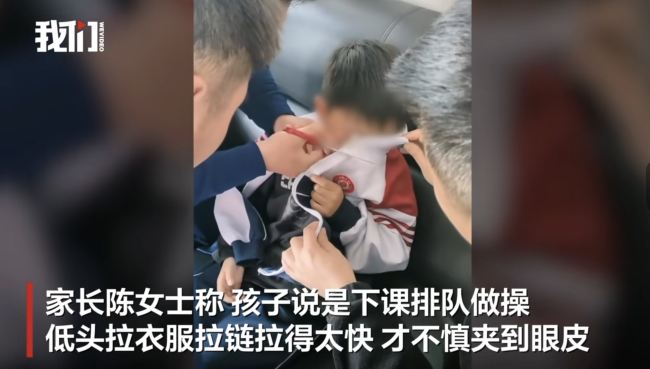 男孩穿校服太着急被拉链夹住眼皮