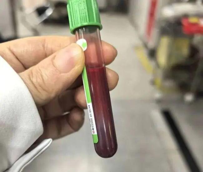 女子孕35周狂吃炸鸡汉堡 一周胖10斤