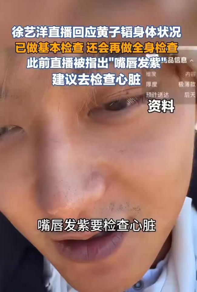 黄子韬回答嘴唇发紫：天生的 已体检