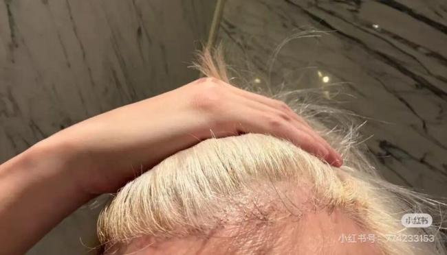 薛之谦自曝因染发导致斑秃 硬挺一周不洗头