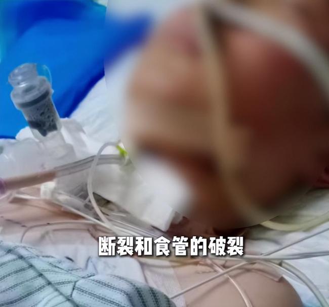 男孩骑车被绳子锁喉仍在抢救 家庭困境引关注