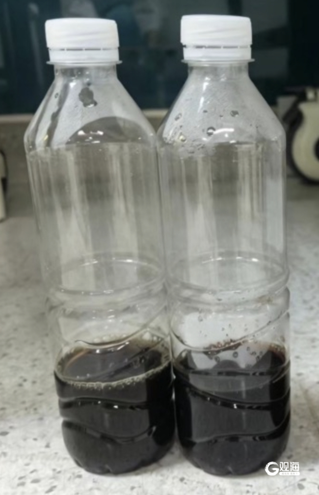 8岁男孩发烧10天尿出酱油色