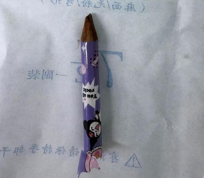 9岁男孩被同学恶作剧铅笔扎进臀部 紧急手术成功取出