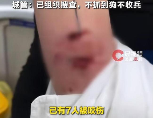 杭州一恶犬无差别咬人 7人受伤引发恐慌