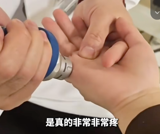 你用小拇指当手机支架吗？快改 避免关节变形