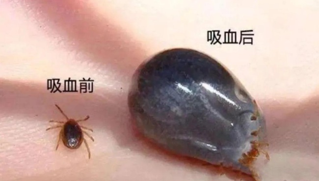 警惕！北京已有多人被叮咬，是什么毒虫？ 蜱虫活跃季需小心