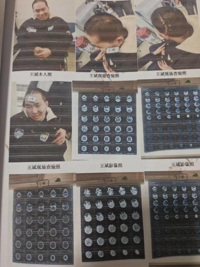 研究生遭遇车祸心智如幼童 两个家庭的悲剧