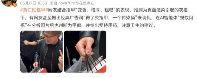 黄仁勋疑似得了灰指甲引热议 AI健康助手给出分析结果