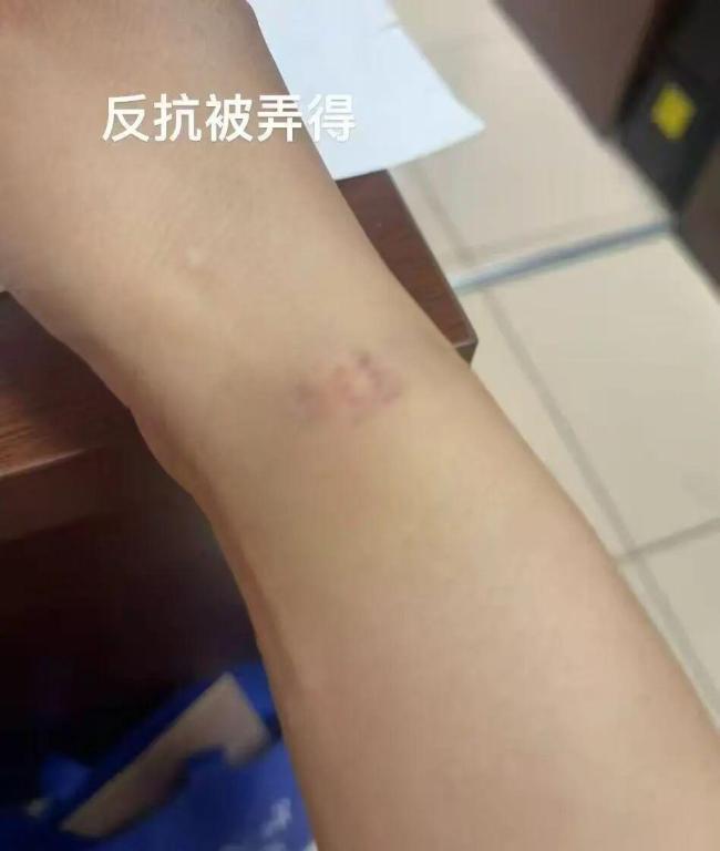 自称遭男医生侵犯女子回应未呼救 高烧无力反抗