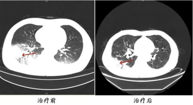开空调前这2个部件一定要洗 警惕军团菌危害