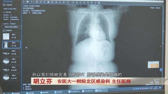69岁老人高烧不退，竟是家中“萌宠”惹祸！